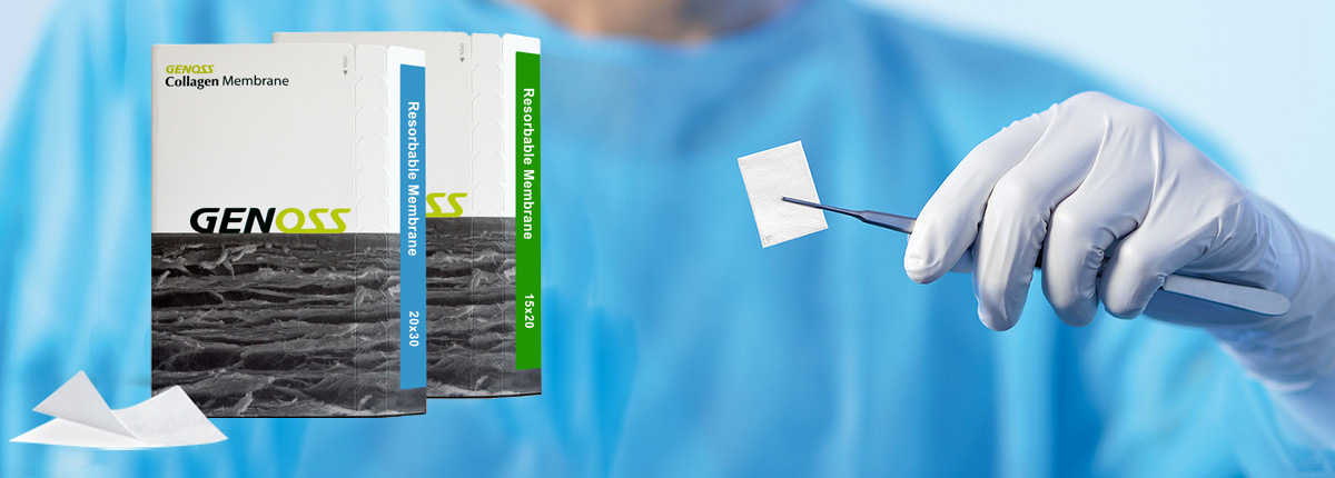 Коллагеновая мембрана. Преимущества Collagen Membrane от Genoss