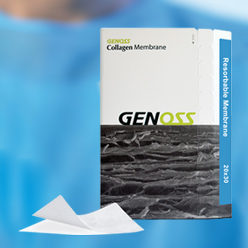 Коллагеновая мембрана. Преимущества Collagen Membrane от Genoss